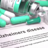 Alzheimers_294492536