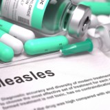 Measles_379770433