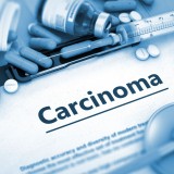 Carcinoma_387475102