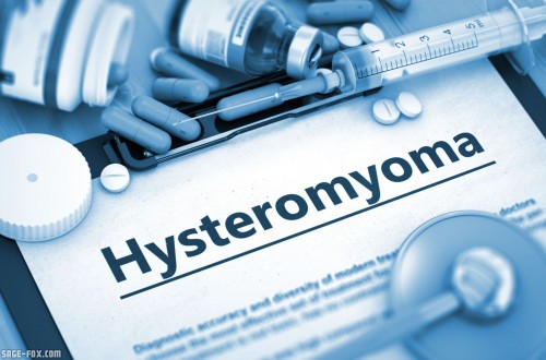Hysteromyoma_409030810.jpg