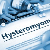 Hysteromyoma_409030810